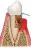 Shopping bags with tissue paper, representing retail therapy or shopping lifestyle imagery.