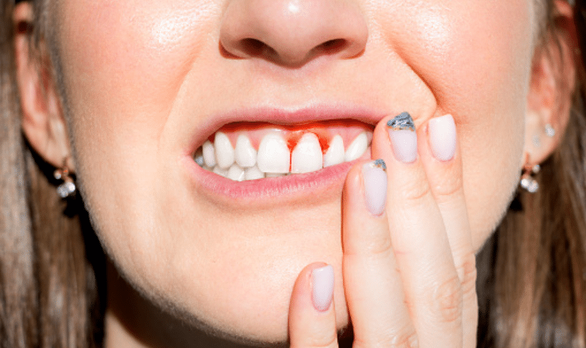 Periodontal Disease