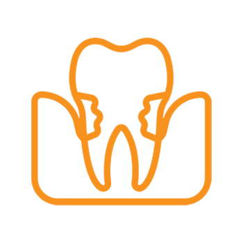Orange line drawing of a tooth with surrounding gum tissue and bone structure illustration.