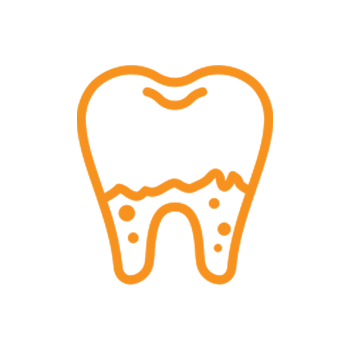 Orange outline of a tooth with a crack or fracture line across the middle section.