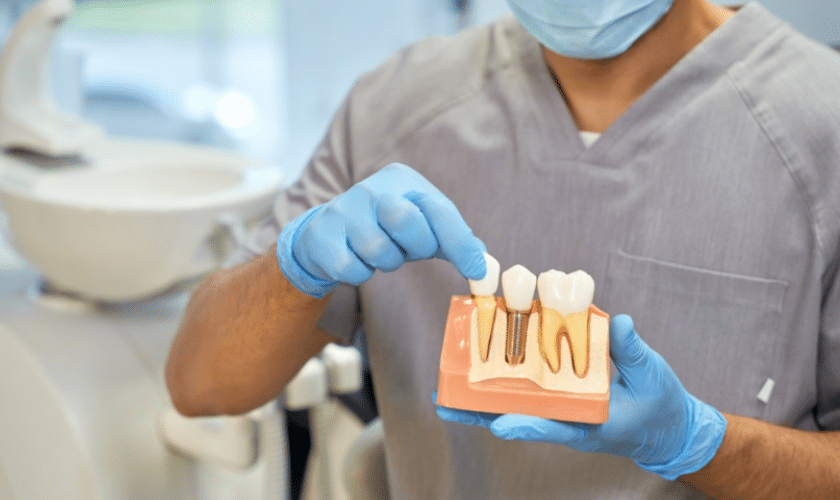 Dental Implants in Lubbock-Lubbock Dental Implant Center