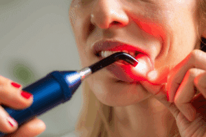Laser Periodontal Therapy