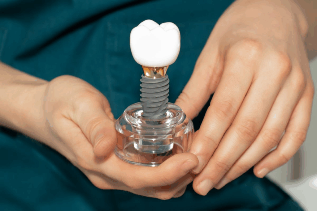 Dental Implants