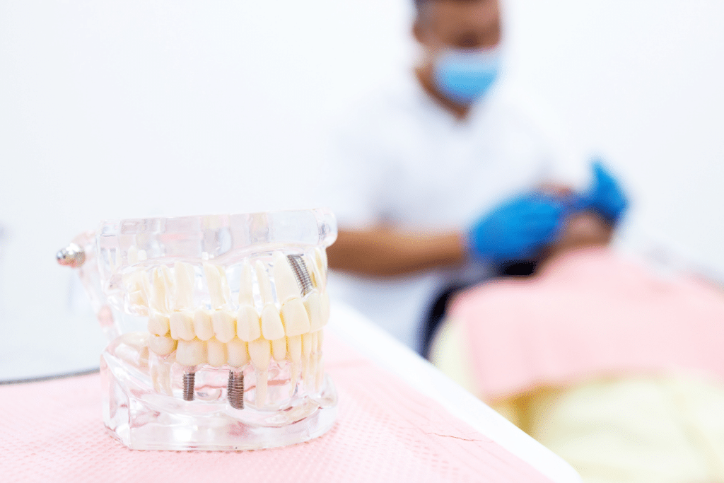 dental implants
