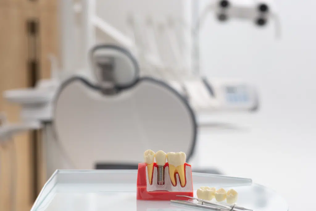 dental implants